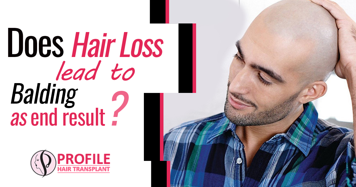 Does Hair Loss Lead To Balding As End Result?