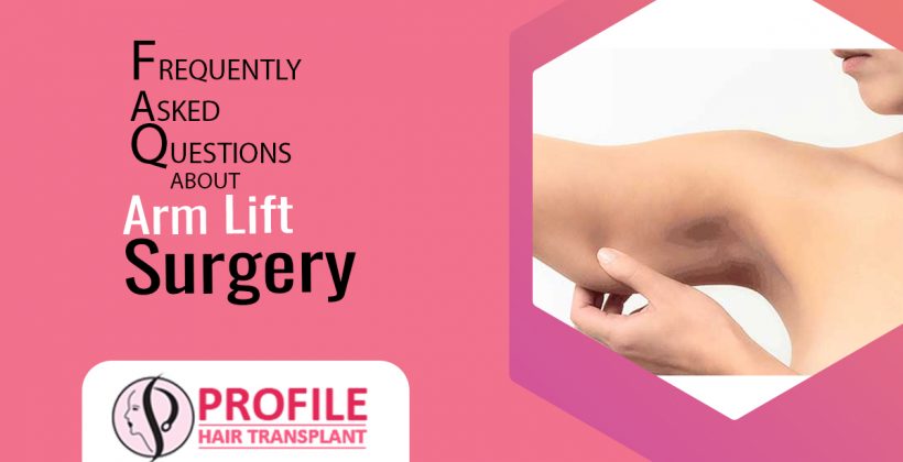 Frequently Asked Questions About Arm Lift Surgery