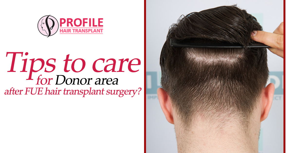 Tips To Care For Donor Area After FUE hair transplant surgery?