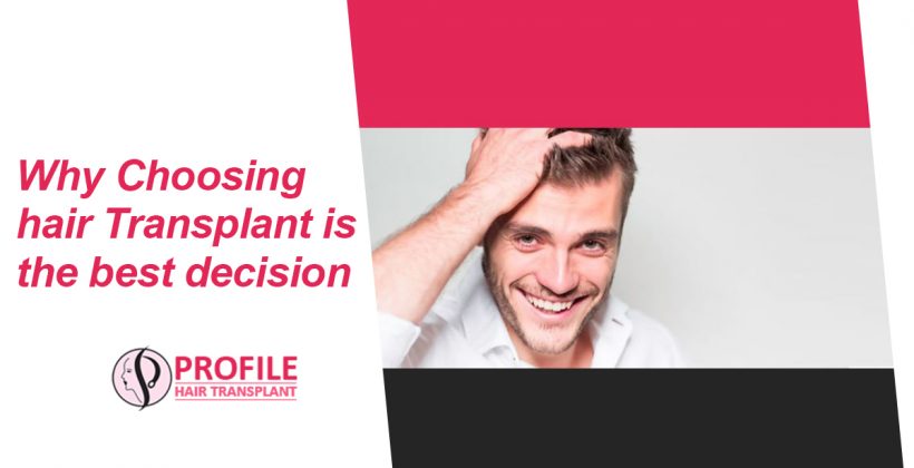 Why Choosing Hair Transplant Is The Best Decision