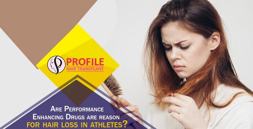 Are Performance Enhancing Drugs Are The Reason For Hair Loss In Athletes?