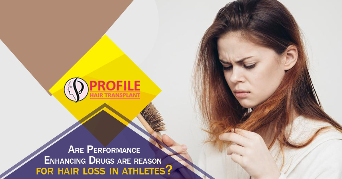 Are Performance Enhancing Drugs Are The Reason For Hair Loss In Athletes?