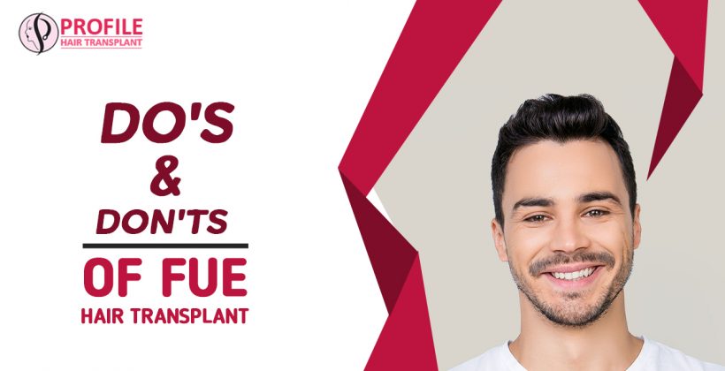 Do’s and Dont’s of FUE Hair Transplant
