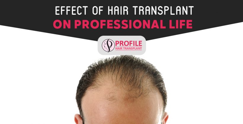 Effect of Hair Transplant On Professional Life