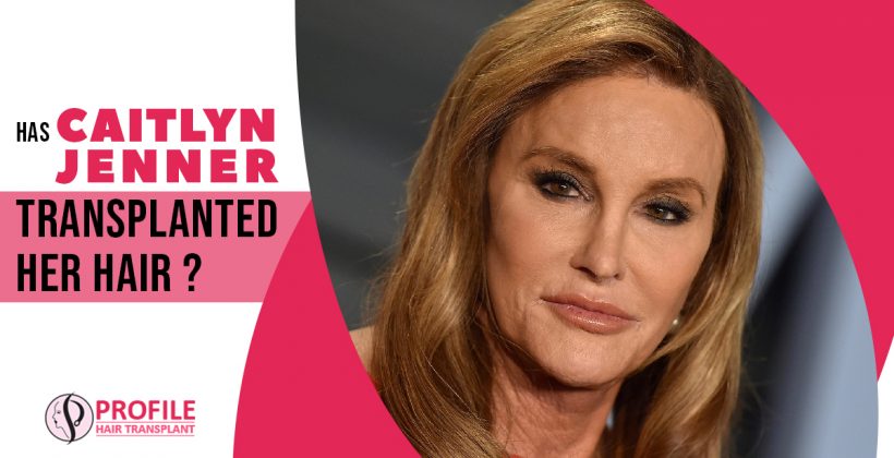 Has Caitlyn Jenner Transplanted Her Hair?