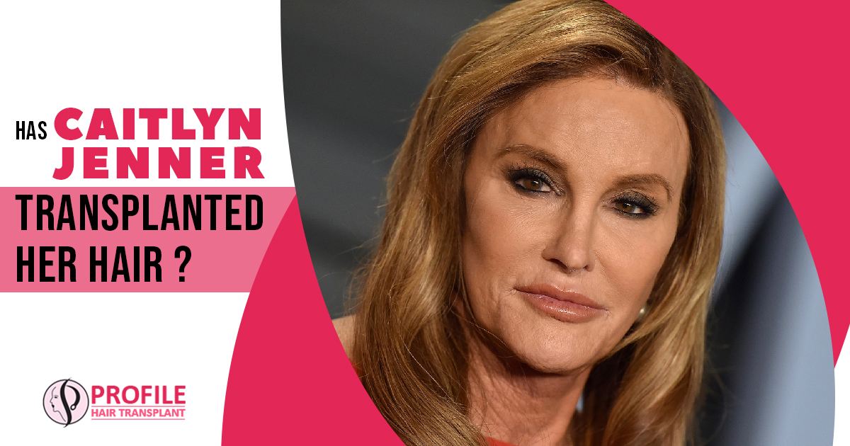 Has Caitlyn Jenner Transplanted Her Hair?