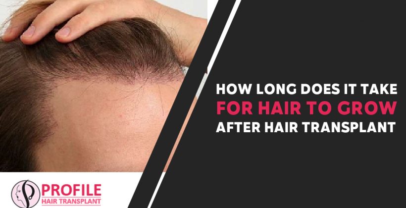How Long Does It Take For Hair To Grow After Hair Transplant