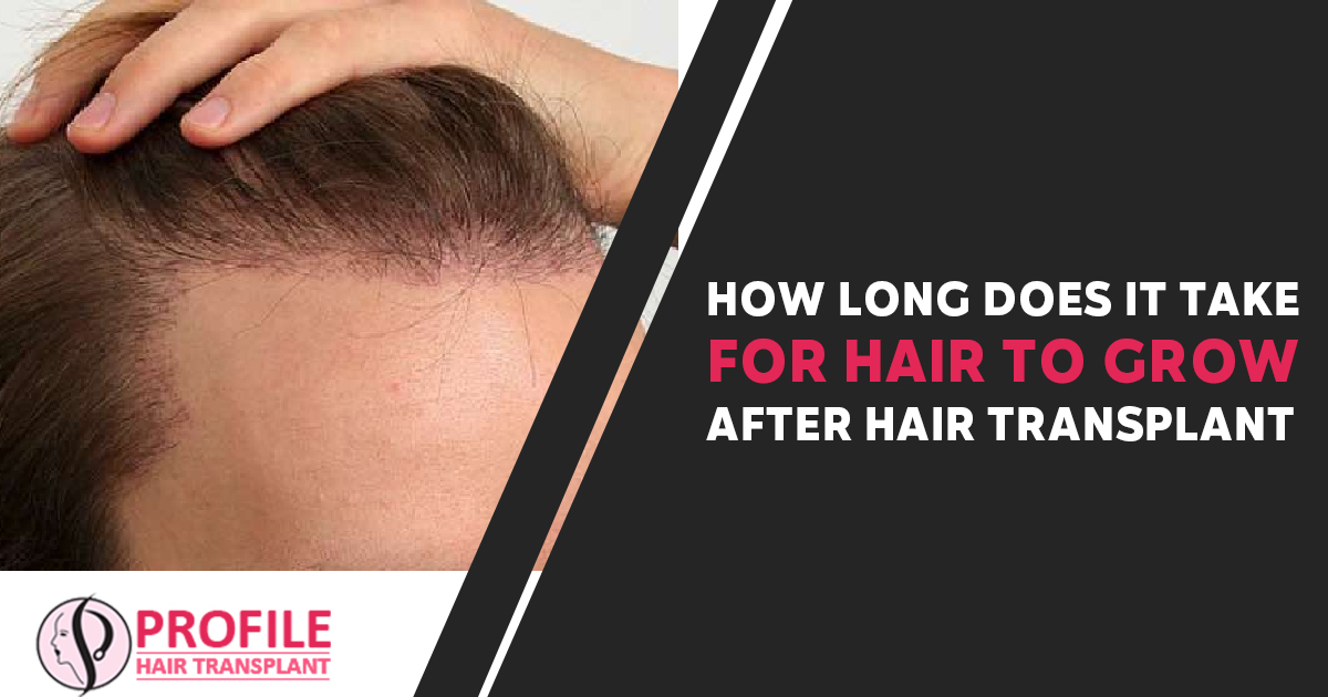 How Long Does It Take For Hair To Grow After Hair Transplant