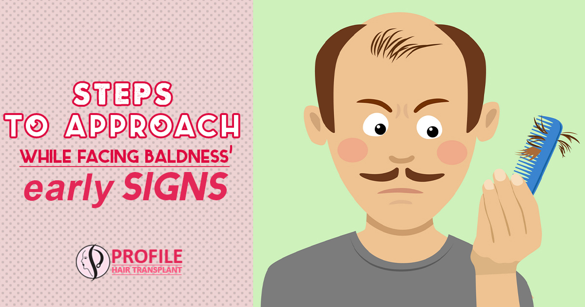 Steps to Approach While Facing Baldness’ Early Signs