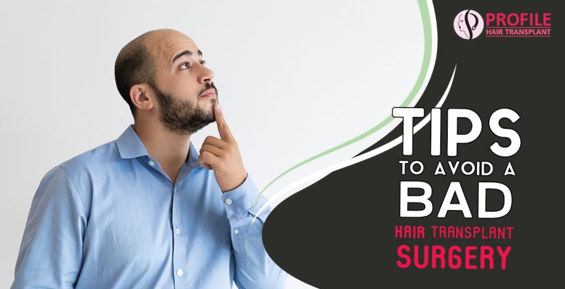 Tips To Avoid A Bad Hair Transplant Surgery