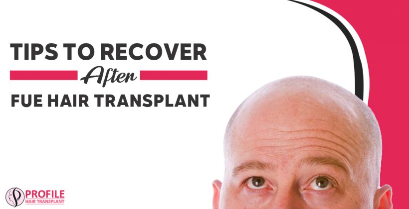 Tips to Recover after FUE Hair Transplant