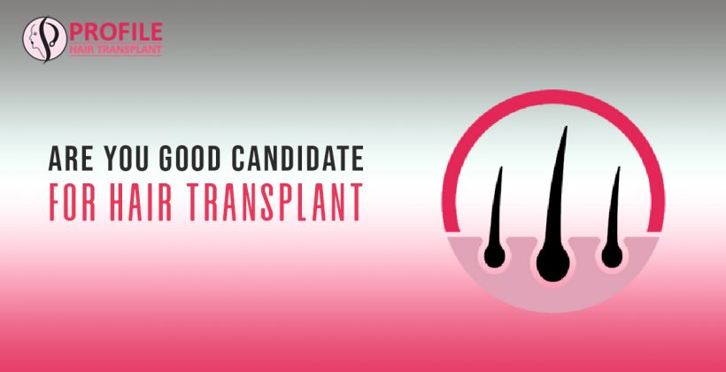 Are you Good Candidate For Hair Transplant