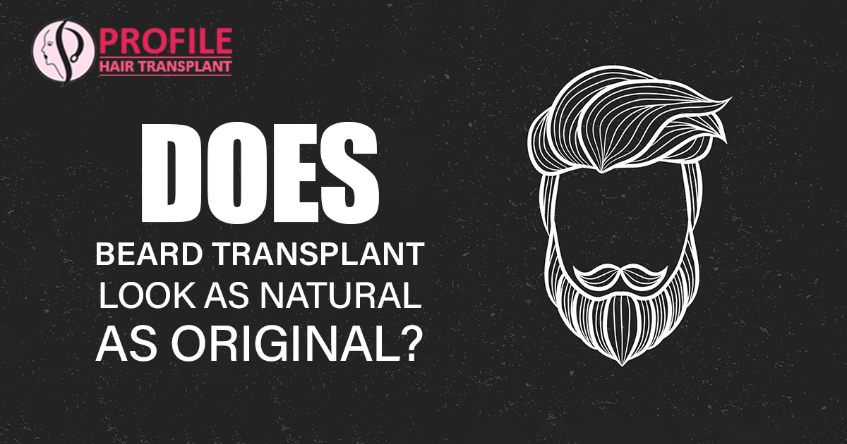 Does Beard Transplant Look As Natural as Original?