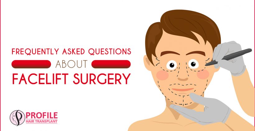 Frequently Asked Questions About Facelift Surgery