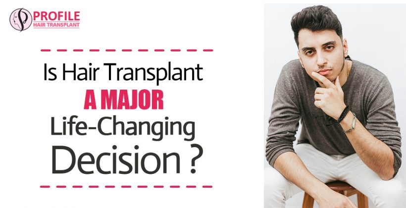 Is Hair Transplant A Major Life Changing Decision?