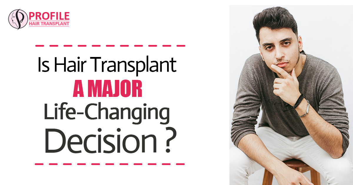 Is Hair Transplant A Major Life Changing Decision?