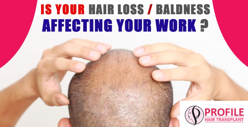 Is Your Hair Loss/Baldness Affecting Your Work?