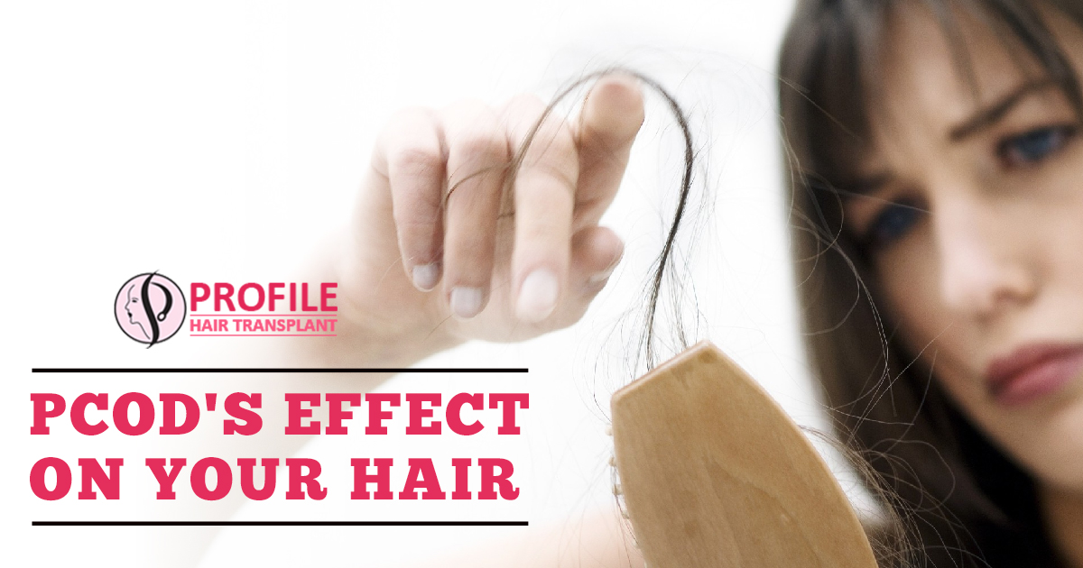 PCOD’s Effect On Your Hair