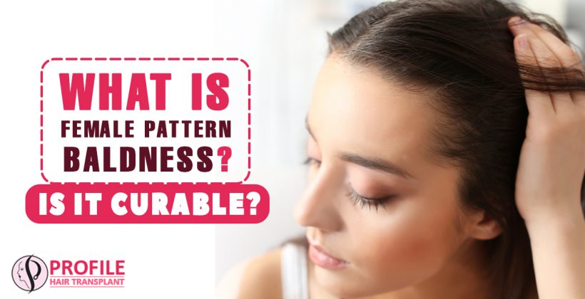 What is Female Pattern Baldness? Is it Curable?