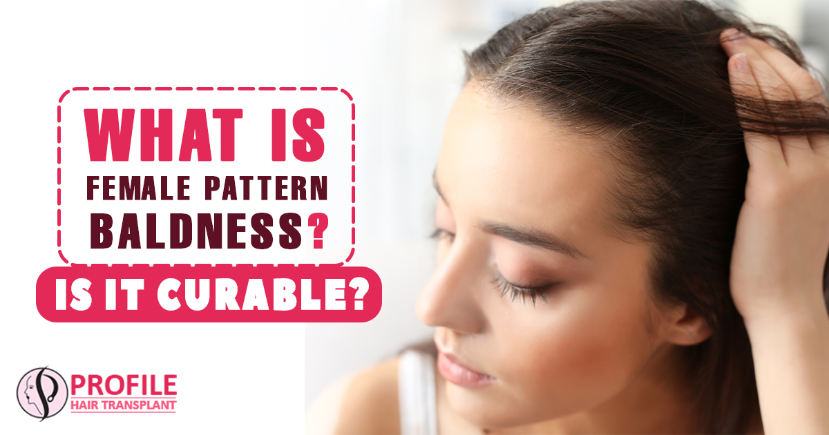 What is Female Pattern Baldness? Is it Curable?
