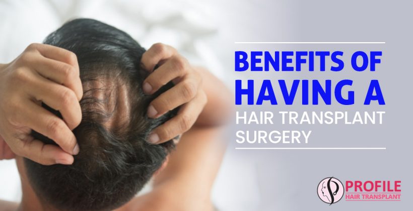 Benefits of Having a Hair Transplant Surgery