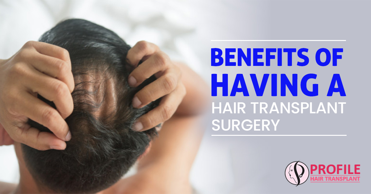 Benefits of Having a Hair Transplant Surgery