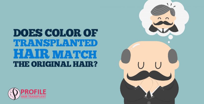 Does Color of Transplanted Hair Match the Original Hair?