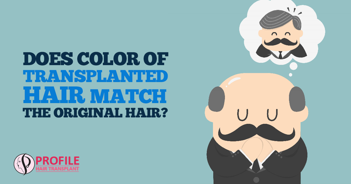 Does Color of Transplanted Hair Match the Original Hair?