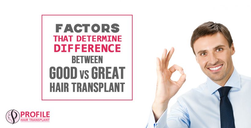 Factors That Determine Difference Between Good Vs Great Hair Transplant