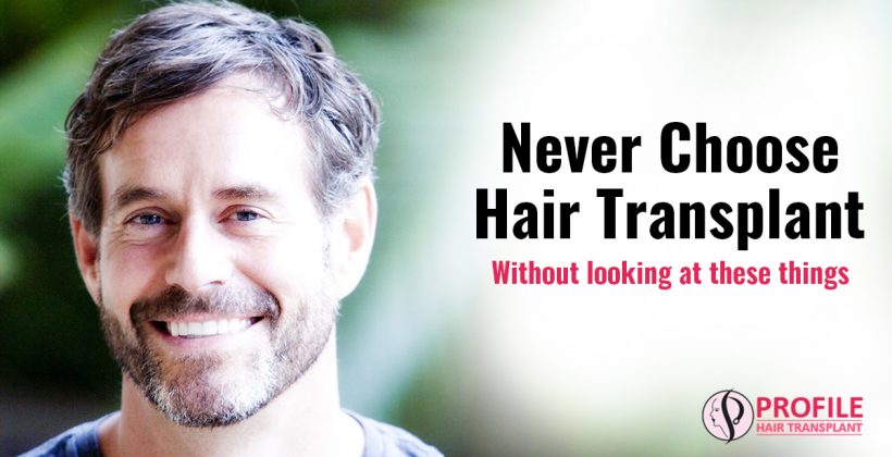 Never Choose Hair Transplant Without looking at these things