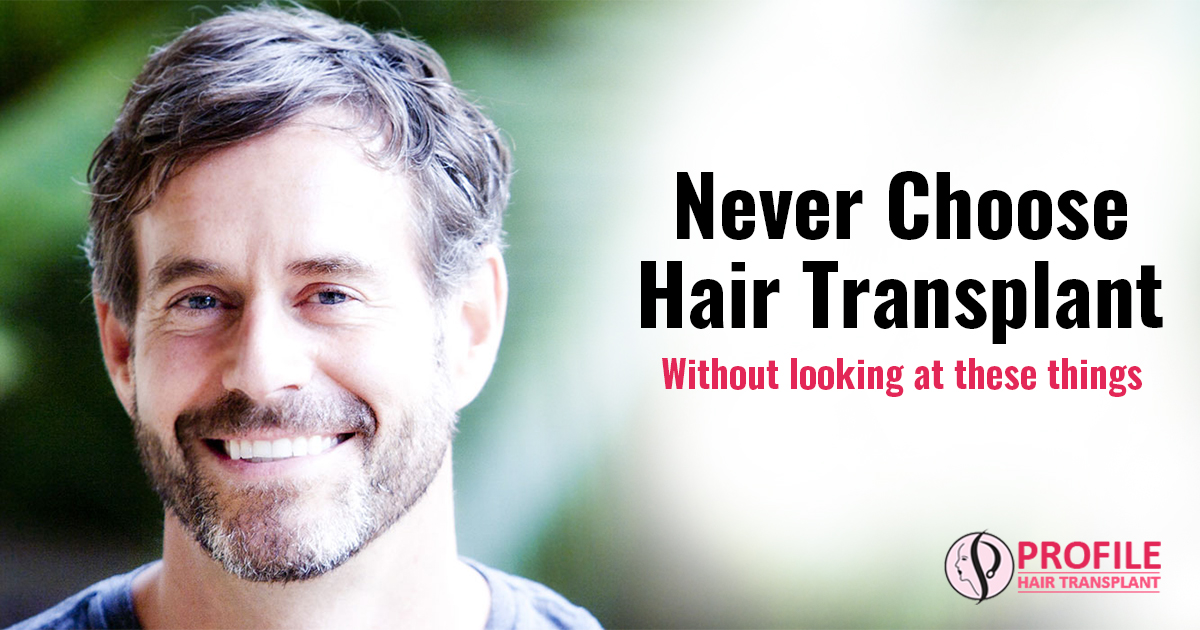 Never Choose Hair Transplant Without looking at these things