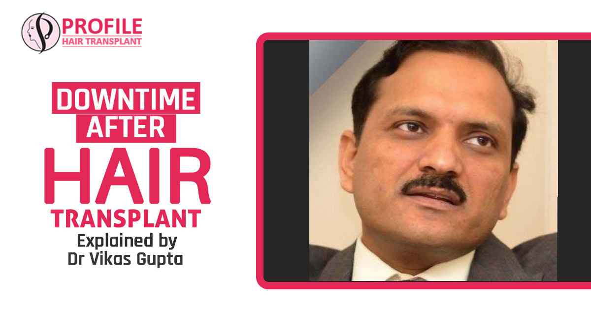 Downtime after Hair Transplant Explained by Dr. Vikas Gupta