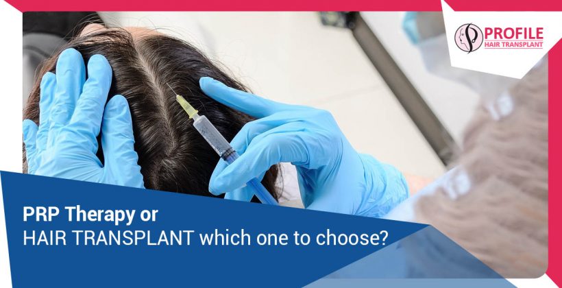 PRP therapy or hair transplant which one to choose?