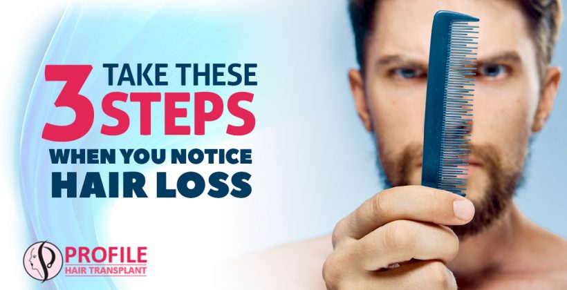Take These 3 Steps When You Notice Hair loss