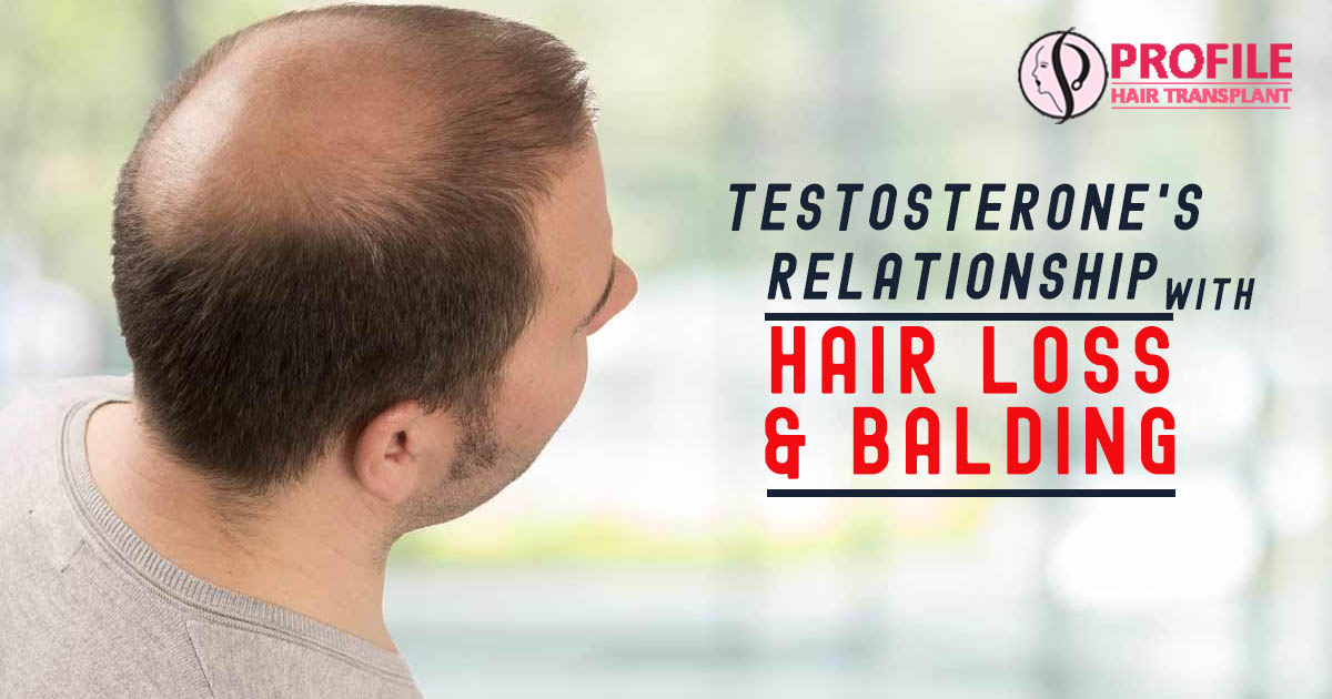 Hair Loss, Balding And Its Relationship With Testosterone