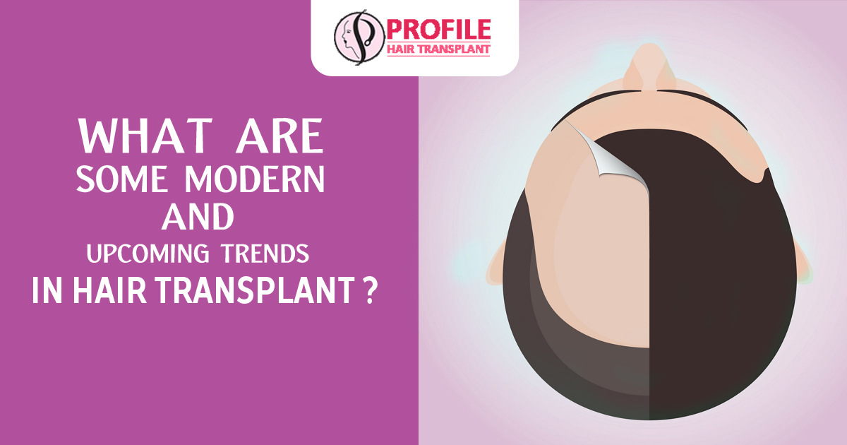 What are some modern and upcoming trends in hair transplant