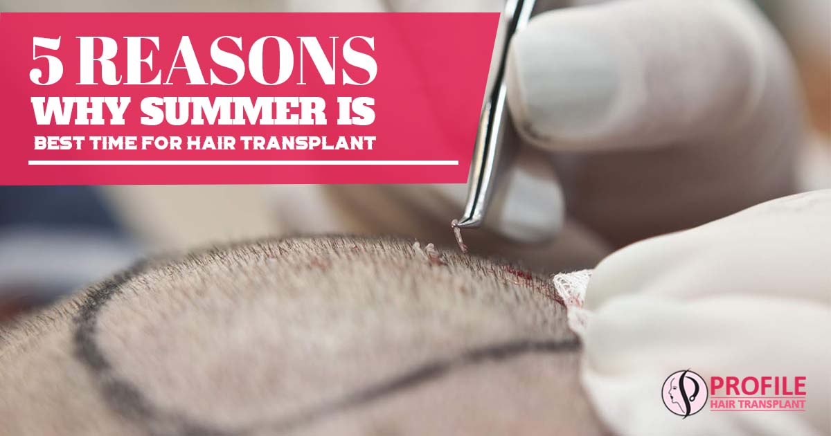 5 Reasons Why Summer is the Best Time for Hair Transplant