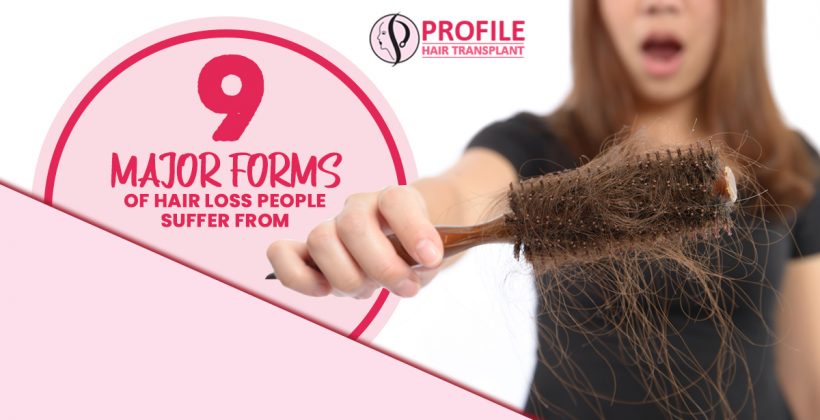 9 Major Forms of Hair Loss People Suffer from