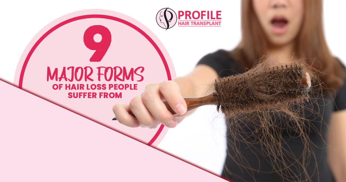 9 Major Forms of Hair Loss People Suffer from