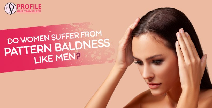 Do Women Suffer from Pattern Baldness Like men?