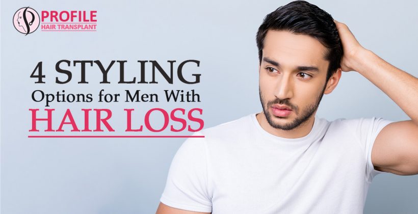 4 Styling Options for Men With Hair Loss