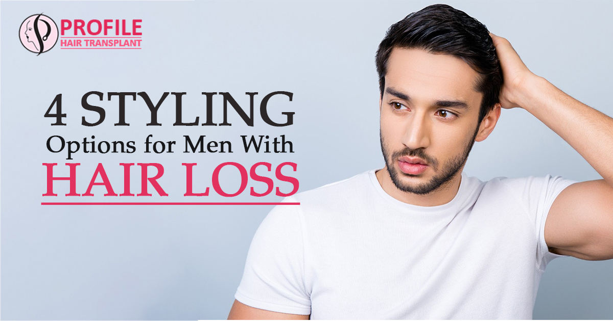 4 Styling Options for Men With Hair Loss