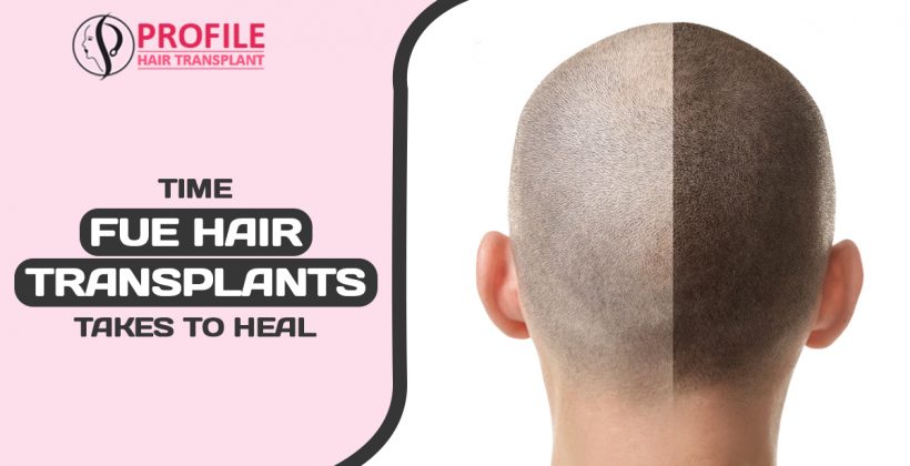 Time FUE Hair Transplants Takes to Heal?