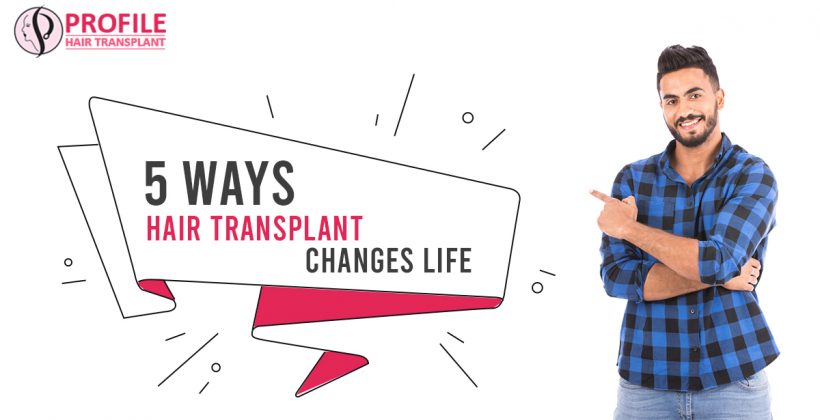 5 Ways Hair Transplant Changes Life