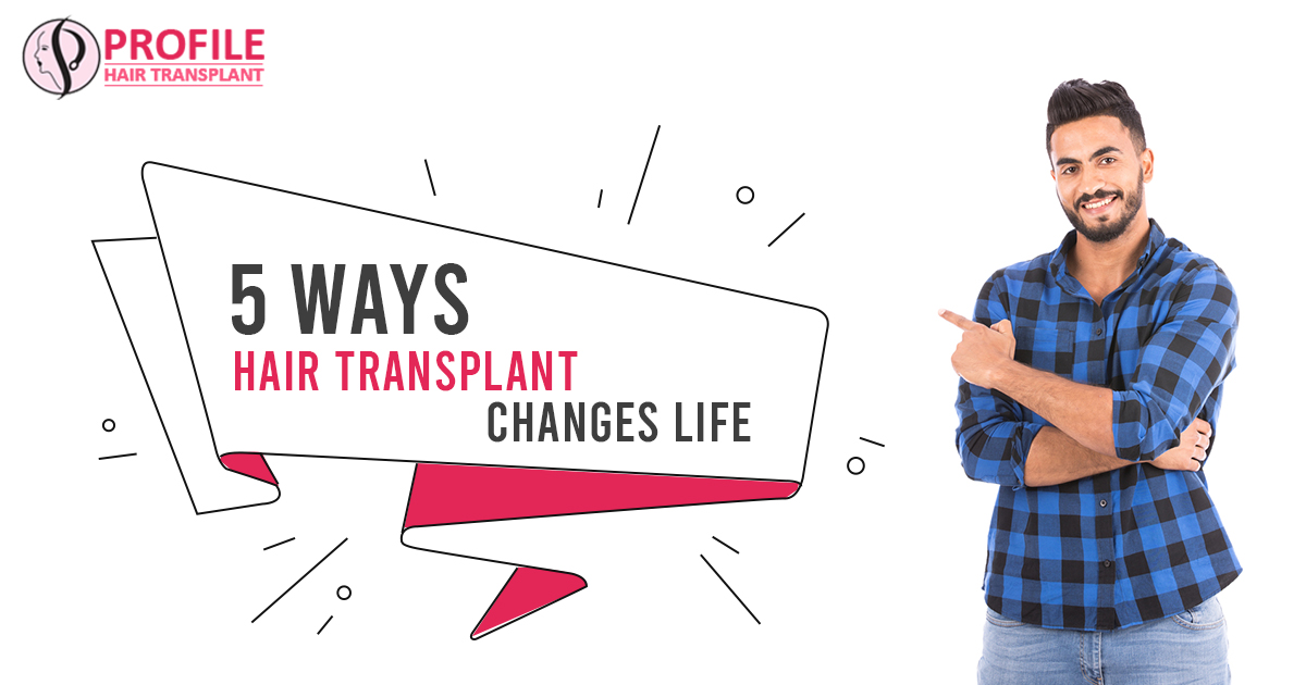 5 Ways Hair Transplant Changes Life