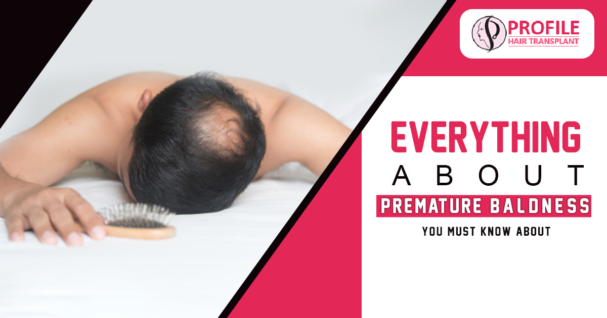 Everything About Premature Baldness Your Must know about