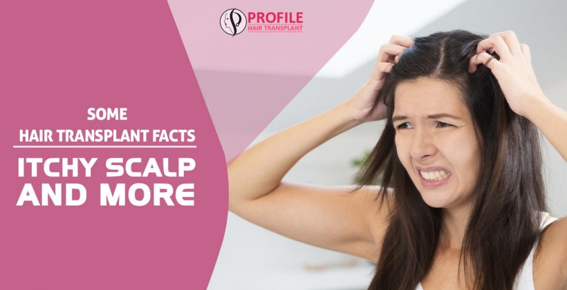 Some Hair Transplant Facts: Itchy Scalp and More