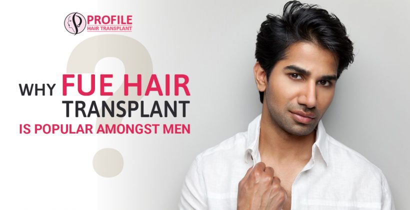 Why FUE Hair Transplant is Popular Amongst Men?