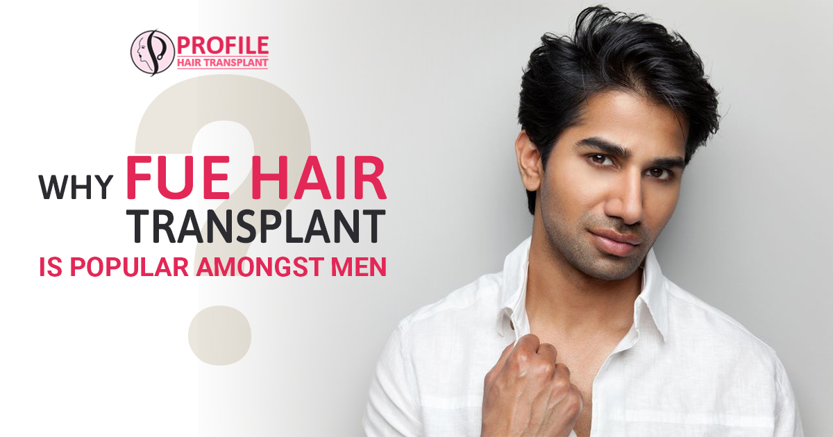 Why FUE Hair Transplant is Popular Amongst Men?