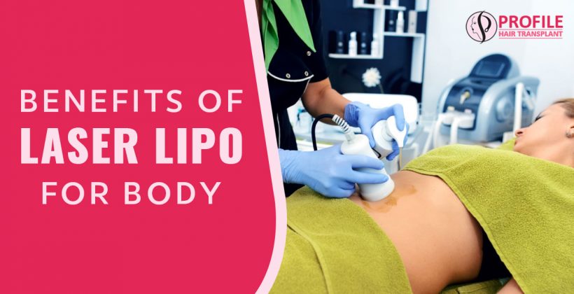 Benefits of Laser Lipo for Body